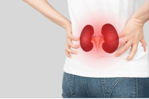 Blood Infection from Kidney Stone: Causes, Risks & Treatment