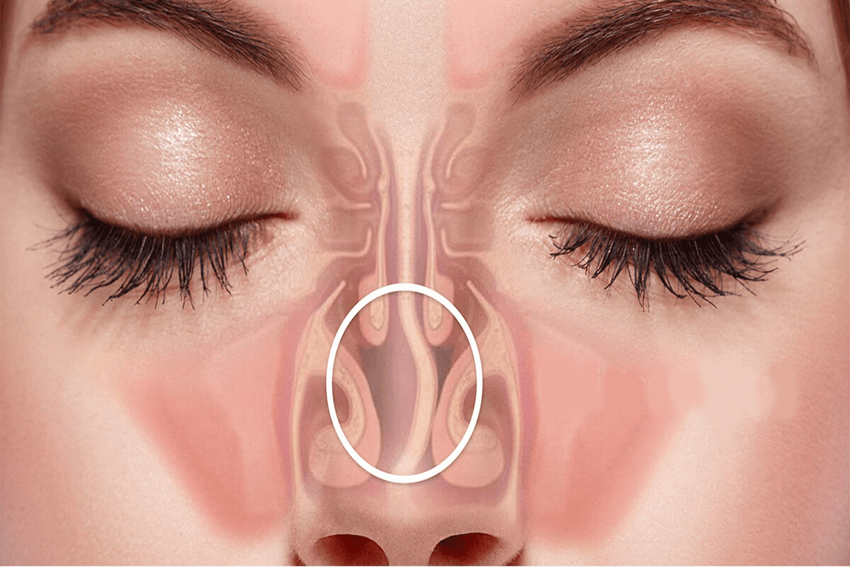 Dry Congested Nose: Why Sinuses Feel Dry and Stuffy 2 Dry Congested Nose: Why Sinuses Feel Dry and Stuffy