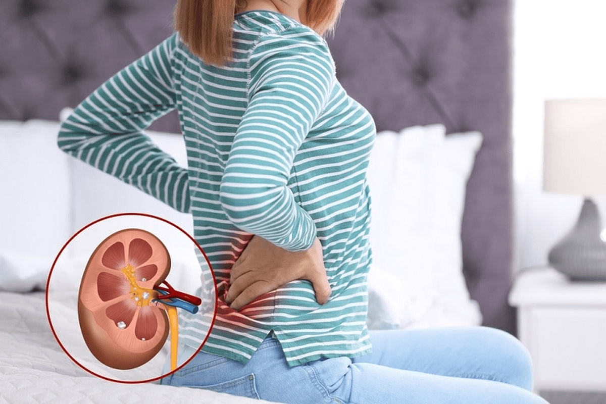 Stage Two Kidney Failure: Symptoms & Treatment