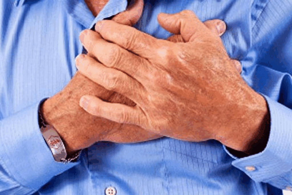 Kidney Stones and Chest Pain: Symptoms 1 Kidney Stones and Chest Pain: Symptoms