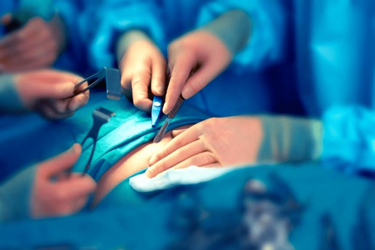 What Is Cystectomy? Medical Definition & Overview