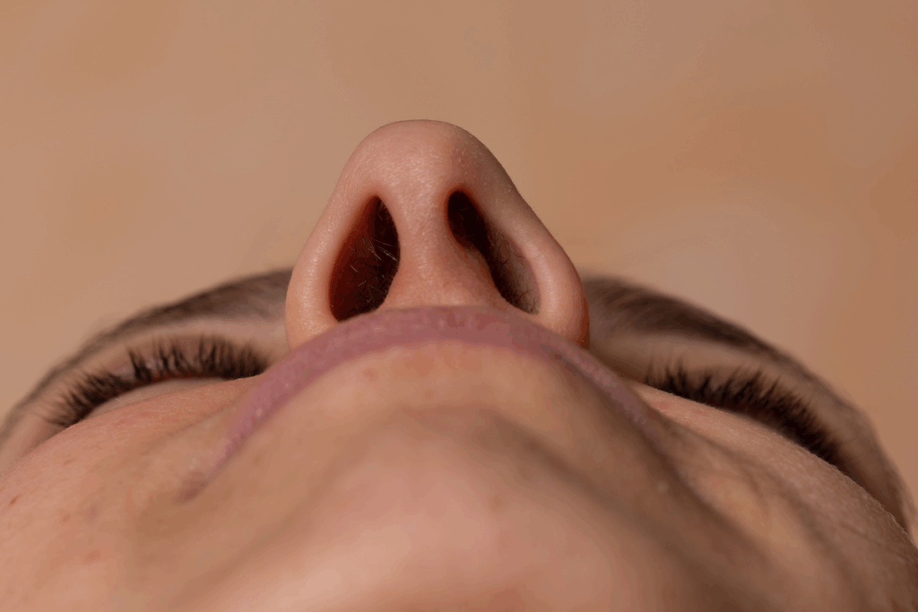 Deviated Septum Surgery Before and After Results 2 Deviated Septum Surgery Before and After Results