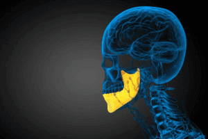 Cancer in the Jaw: Key Symptoms
