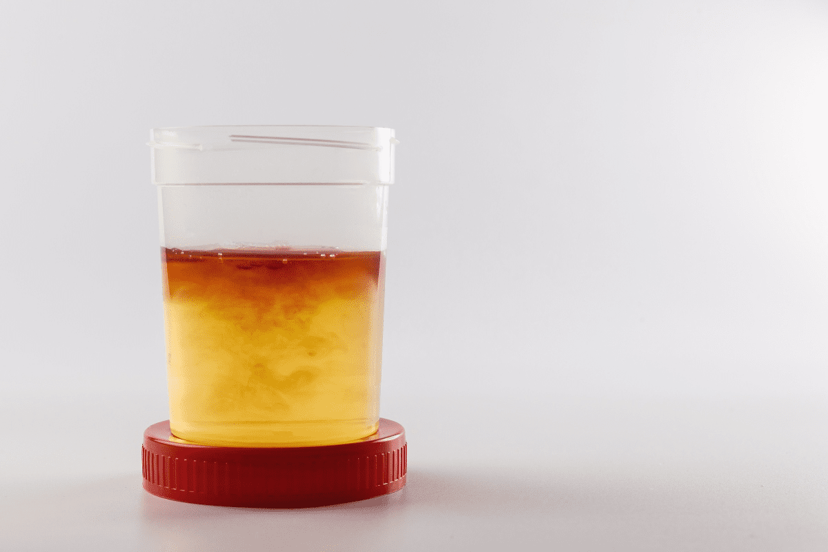 Blood in Urine: Causes and What It Means