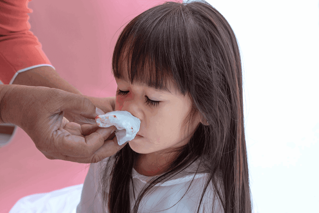Blood Nasal Drip: Remedies and Treatment