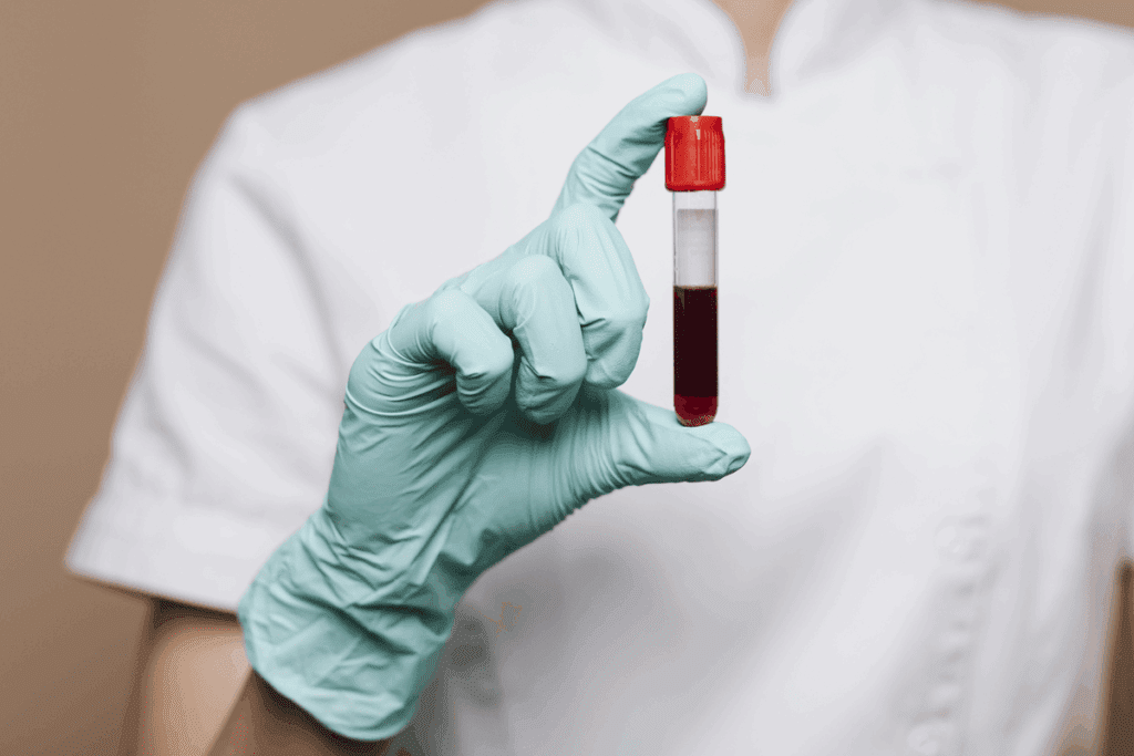 Occult Blood in Urine Positive Means: Explained 2 Occult Blood in Urine Positive Means: Explained