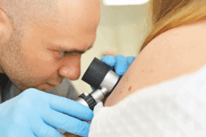 What Does Skin Cancer on the Scalp Look Like