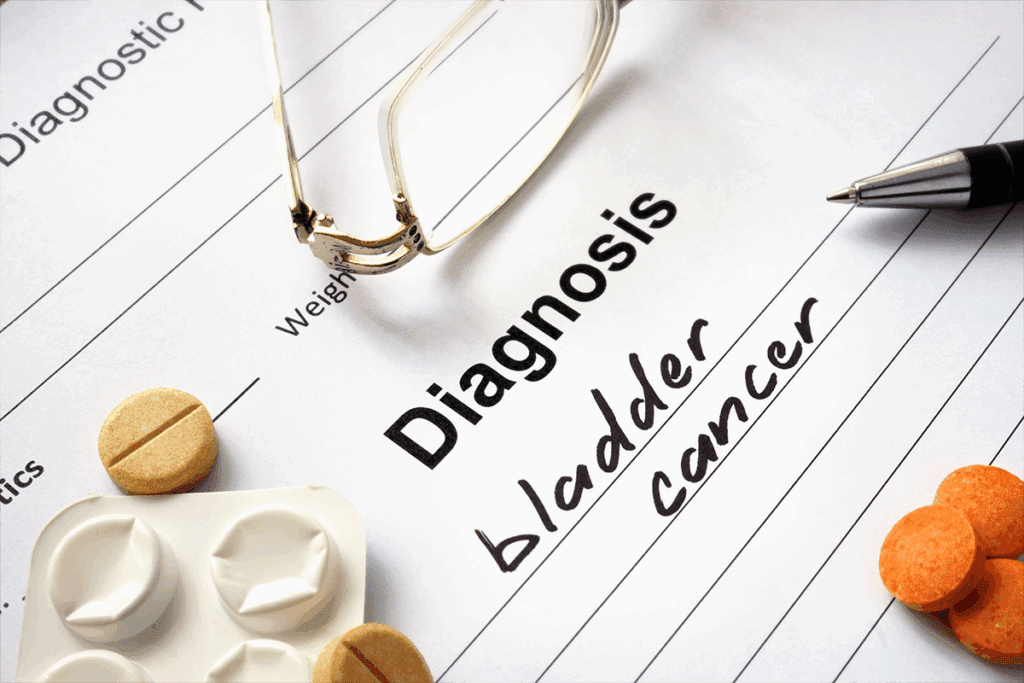 Squamous Cells Bladder: What Is Squamous Cell Carcinoma?