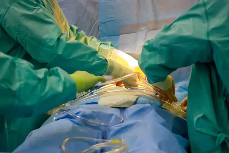 How Long Does Bypass Surgery Last and What Is Life Expectancy After Heart Bypass?