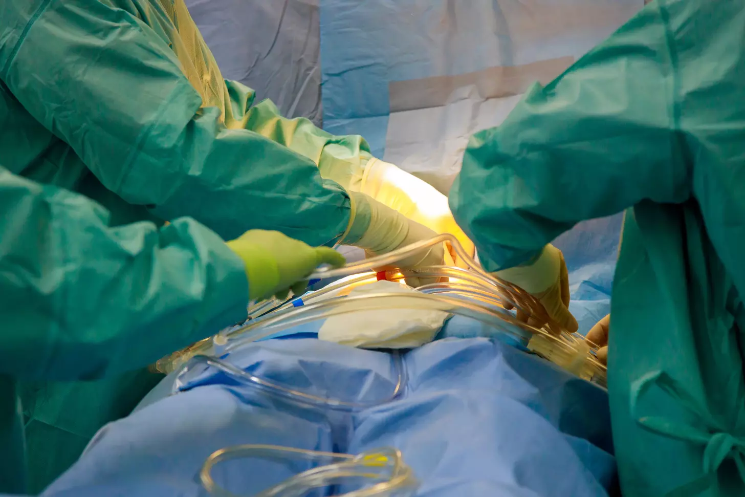 How Long Does Bypass Surgery Last and What Is Life Expectancy After Heart Bypass?