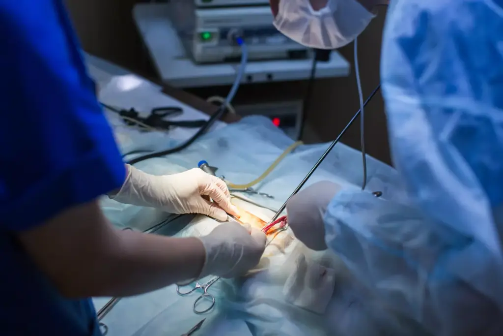 How Long Does Heart Bypass Surgery Take? How Long Does Heart Bypass Surgery Take?