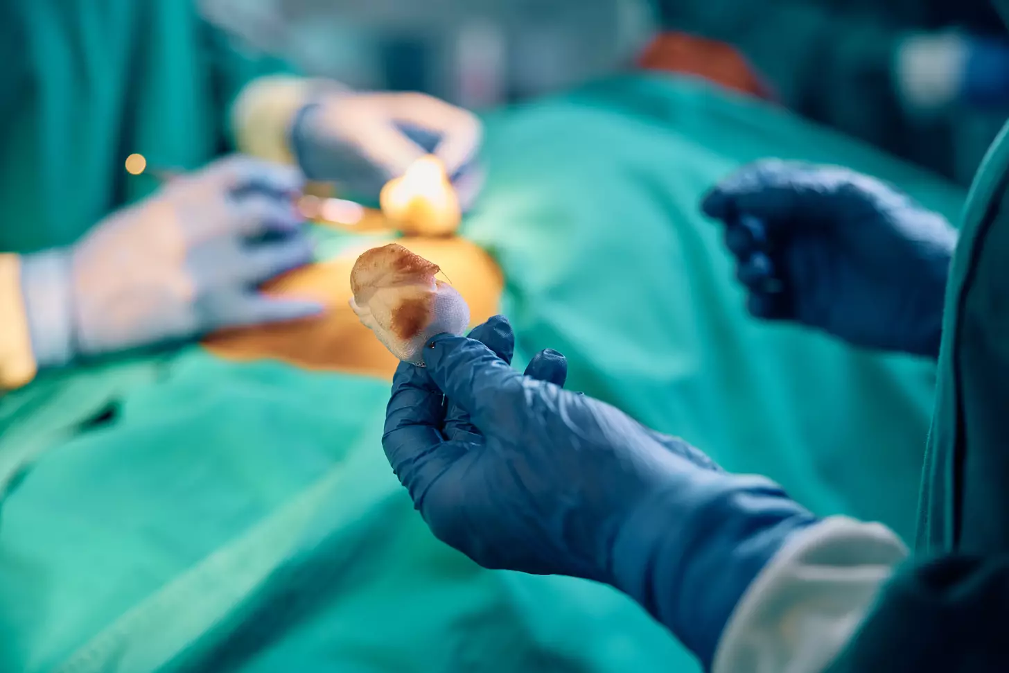 Indications for Bypass Surgery: 7 Key CABG Criteria You Should Know
