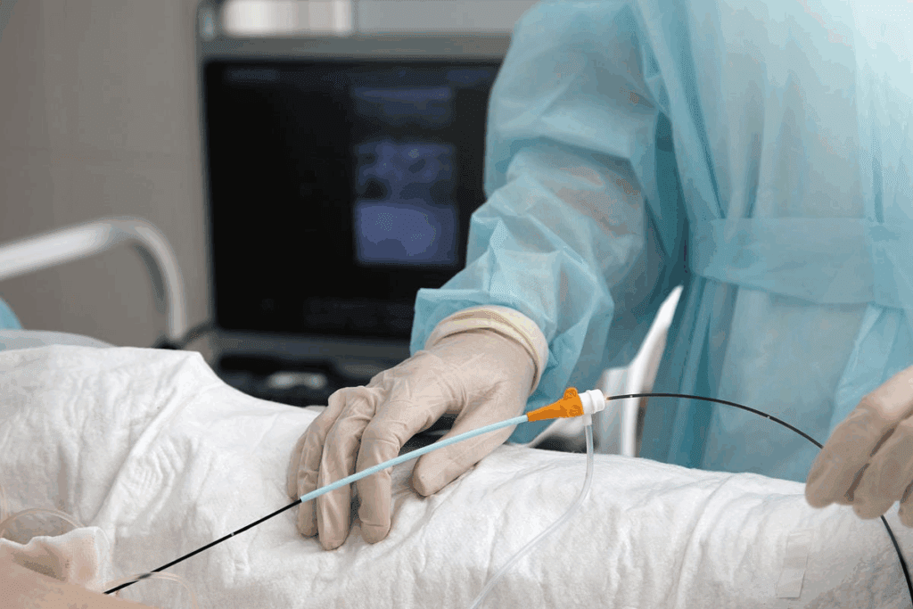 Do and Don’ts After Heart Ablation