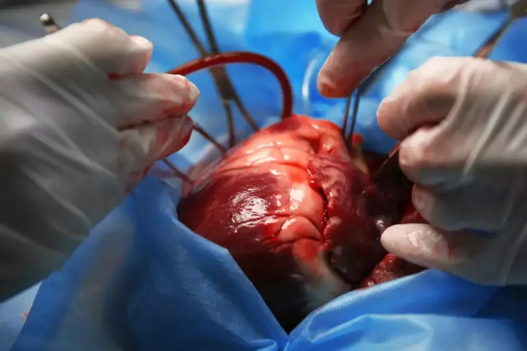 Heart Valve Replacement Surgery: 7 Main Types and Options Explained