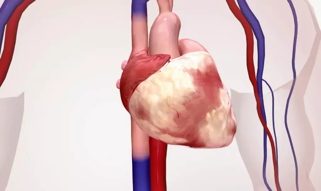 A detailed anatomical cross-section of a bicuspid aortic valve, showcasing its unique two-leaflet structure against a subtly blurred, clinical backdrop. The valve is rendered in high-definition, with precise depictions of the cusps, commissures, and surrounding aortic wall. Soft, directional lighting illuminates the intricate valve geometry, emphasizing its complex yet elegant form. The overall mood is one of scientific curiosity and medical precision, inviting the viewer to closely examine this critical cardiac structure. The perspective is slightly angled to provide optimal visibility, allowing for a comprehensive understanding of the bicuspid aortic valve's distinctive morphology. A detailed anatomical cross-section of a bicuspid aortic valve, showcasing its unique two-leaflet structure against a subtly blurred, clinical backdrop. The valve is rendered in high-definition, with precise depictions of the cusps, commissures, and surrounding aortic wall. Soft, directional lighting illuminates the intricate valve geometry, emphasizing its complex yet elegant form. The overall mood is one of scientific curiosity and medical precision, inviting the viewer to closely examine this critical cardiac structure. The perspective is slightly angled to provide optimal visibility, allowing for a comprehensive understanding of the bicuspid aortic valve's distinctive morphology.