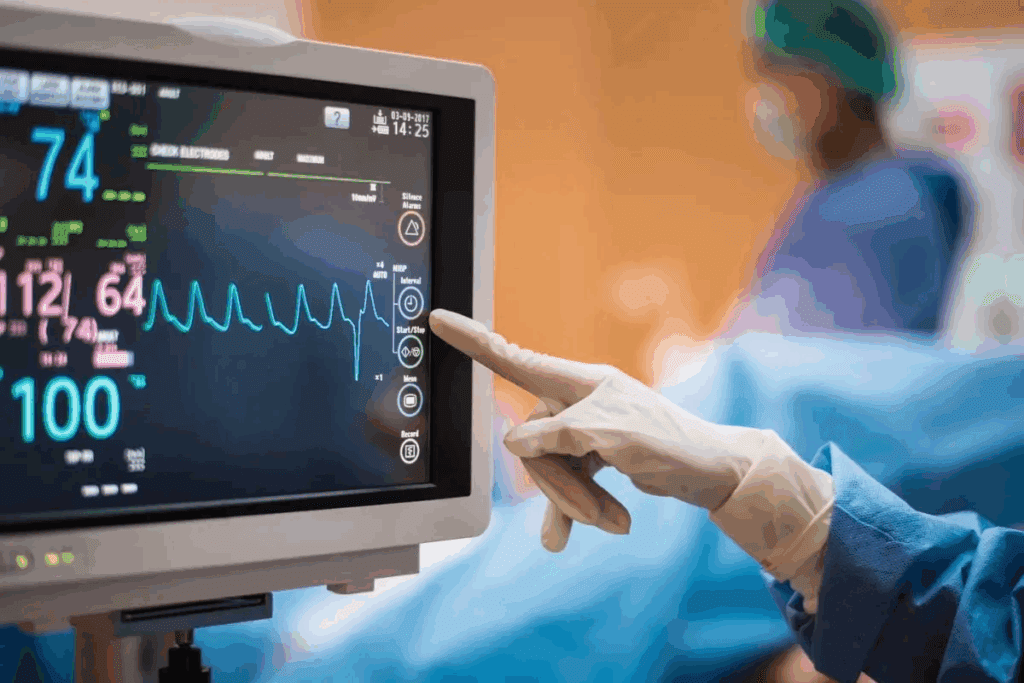 Complete Heart Block: ECG Findings 2 Complete Heart Block: ECG Findings