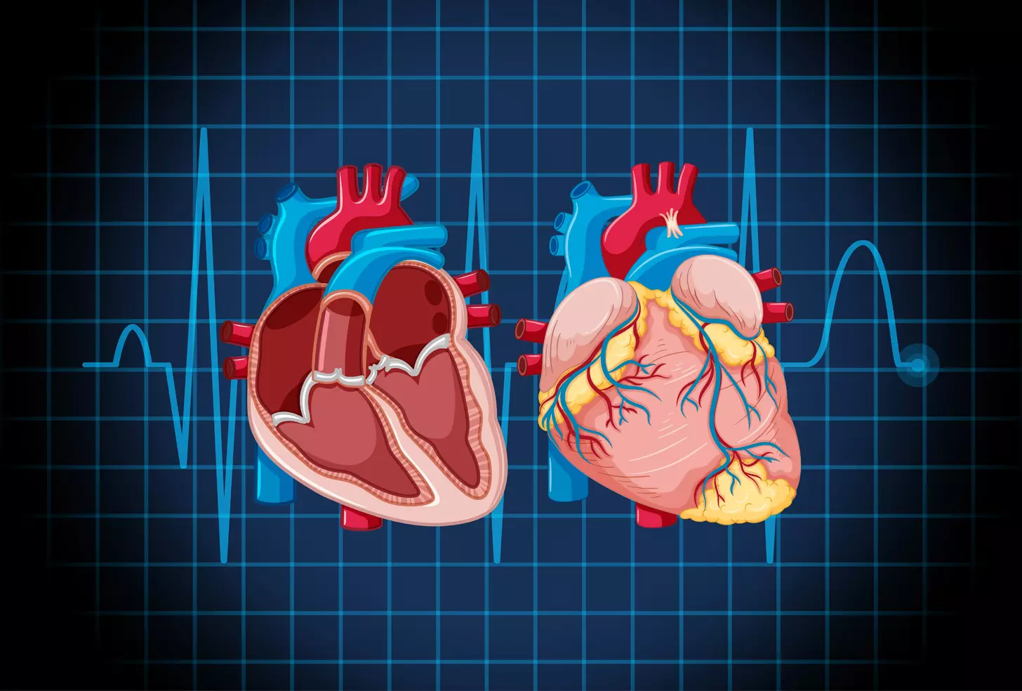 What Is Atrial Fibrillation After Surgery and Why Does It Matter?