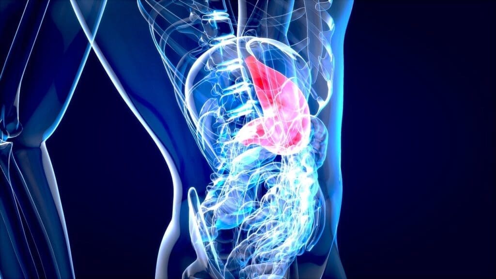 atherosclerotic abdominal aorta