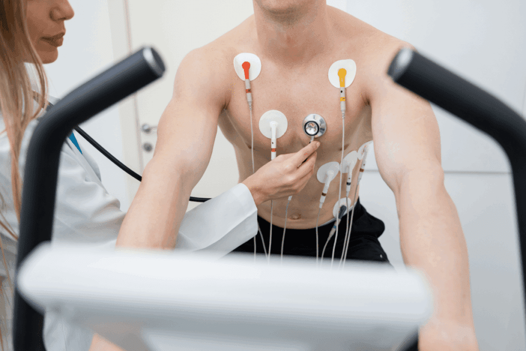 What Is a Treadmill Stress Test