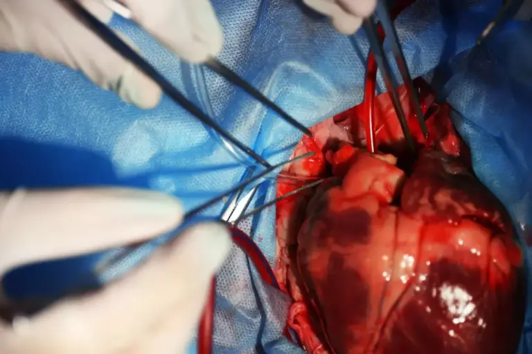 How Long Does Aortic Valve Replacement Surgery Take? Timeframes & Factors Explained