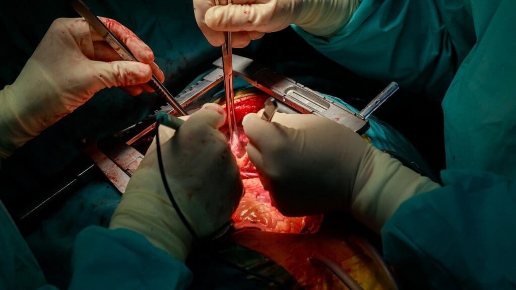 aneurysm removal aneurysm removal