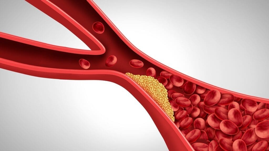Basic Anatomy of Blood Vessels Basic Anatomy of Blood Vessels