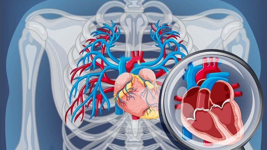 Bicuspid Aortic Valve Risk Factors Bicuspid Aortic Valve Risk Factors