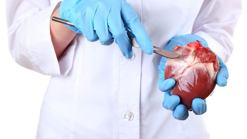 bicuspid aortic valve structure bicuspid aortic valve structure