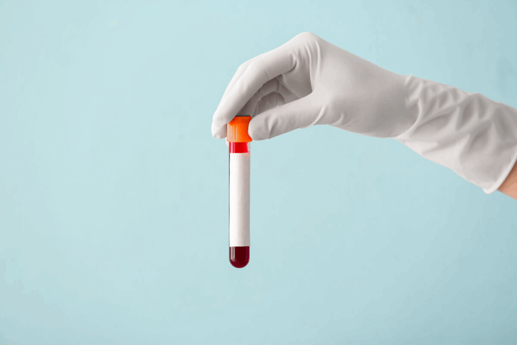 Blood Thinner Side Effects Explained
