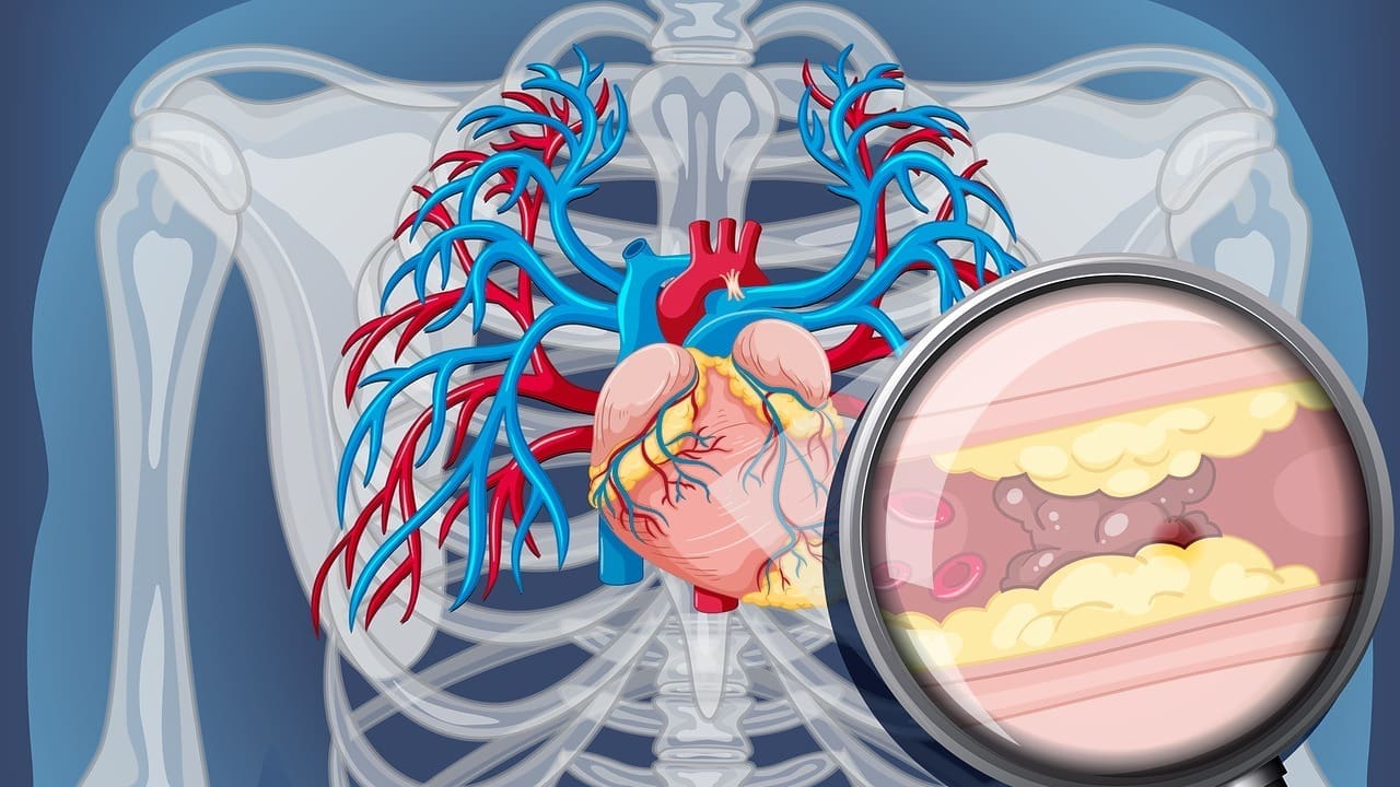 What Is Ectatic Ascending Thoracic Aorta and How Does It Differ from Thoracic Aortic Ectasia?