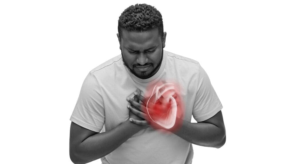 aortic dilation symptoms