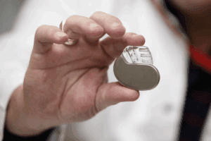 Pacemaker for Atrial Fib: How It Helps