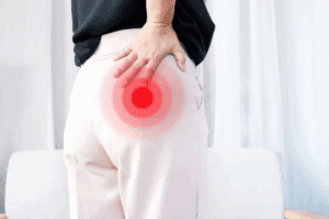 Hip Ablation: 7 Key Facts for Nerve Pain