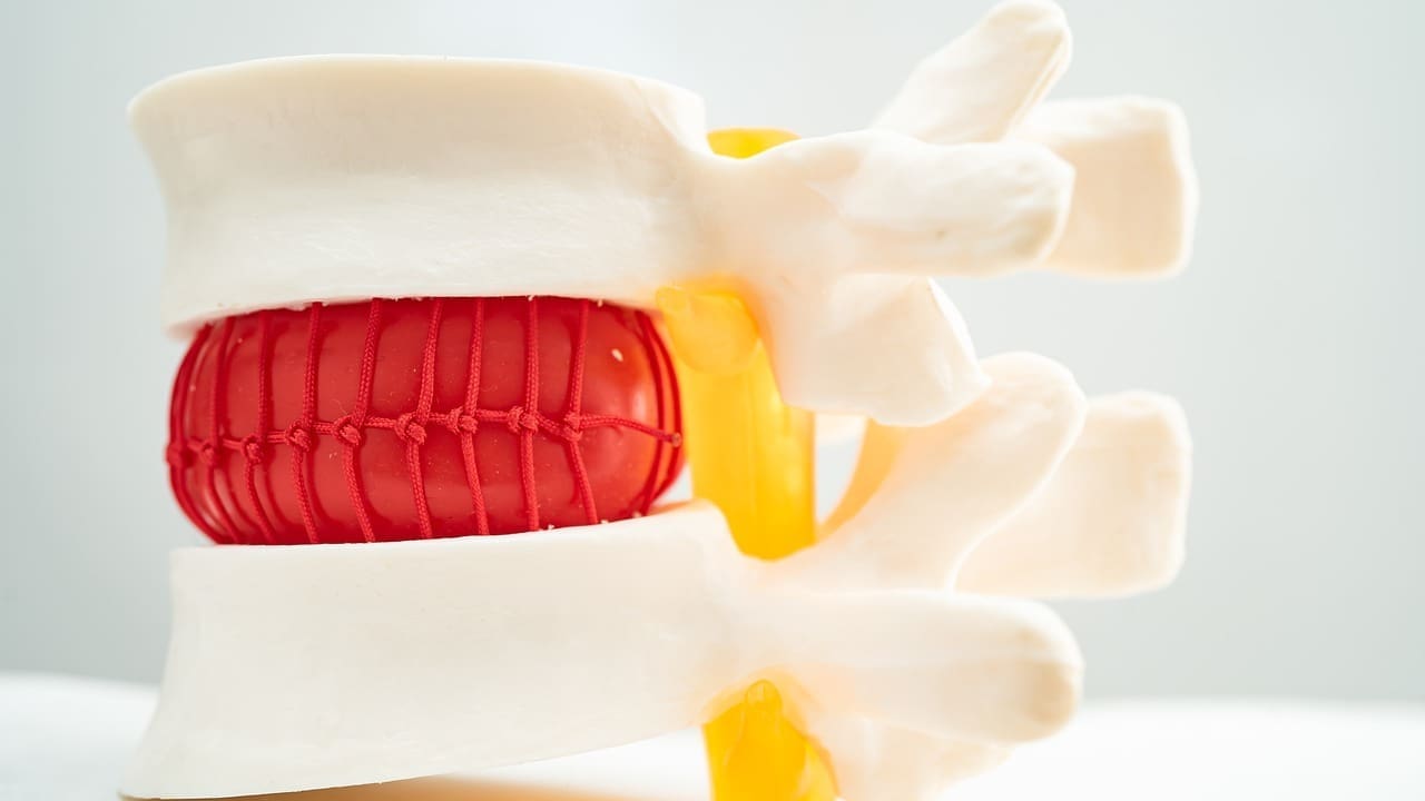 picture of bulging disc