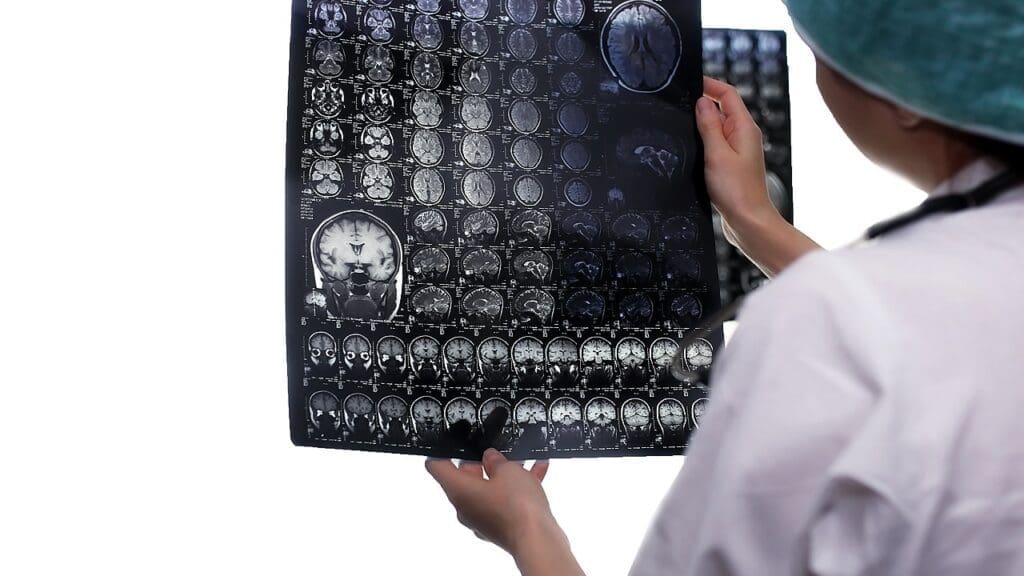 MRI brain imaging MRI brain imaging