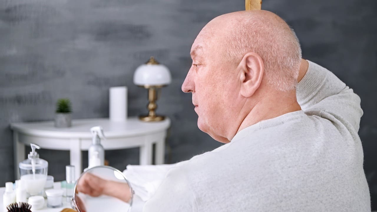 How Does Brain Cancer or Tumor Treatment Cause Hair Loss and What Can You Expect?