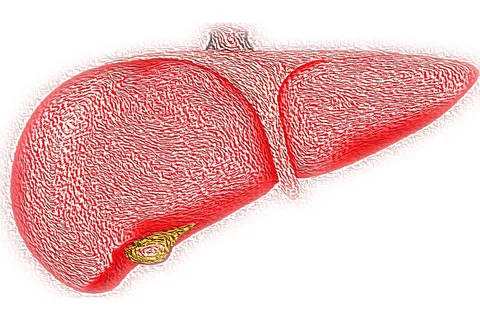 How Long Does a Biliary Drain Stay In? Guide