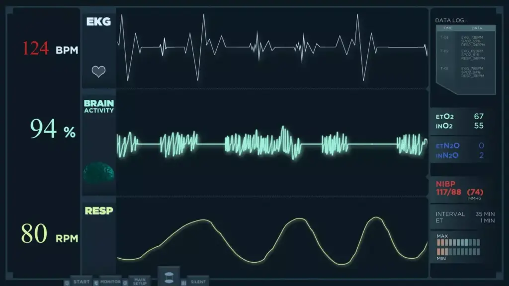 A detailed, real-time ECG readout showing the fluctuating heart rate during an episode of atrial fibrillation. The foreground displays the pulsating waveform, with irregular peaks and valleys reflecting the abnormal cardiac rhythm. The middle ground features a clean, minimalist interface with vital stats like BPM and rhythm status. The background has a muted, clinical palette of grays and blues, creating a sense of medical precision. Crisp, high-resolution rendering with balanced lighting and a shallow depth of field, drawing the viewer's focus to the central ECG display.