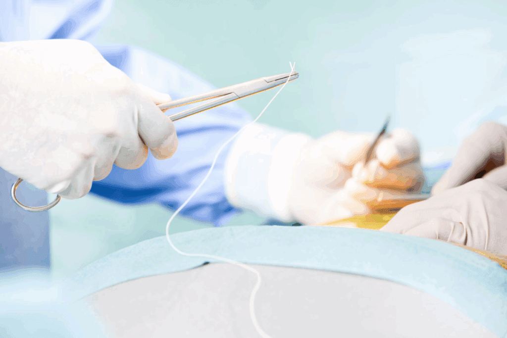 Irreversible electroporation: The Ultimate Guide