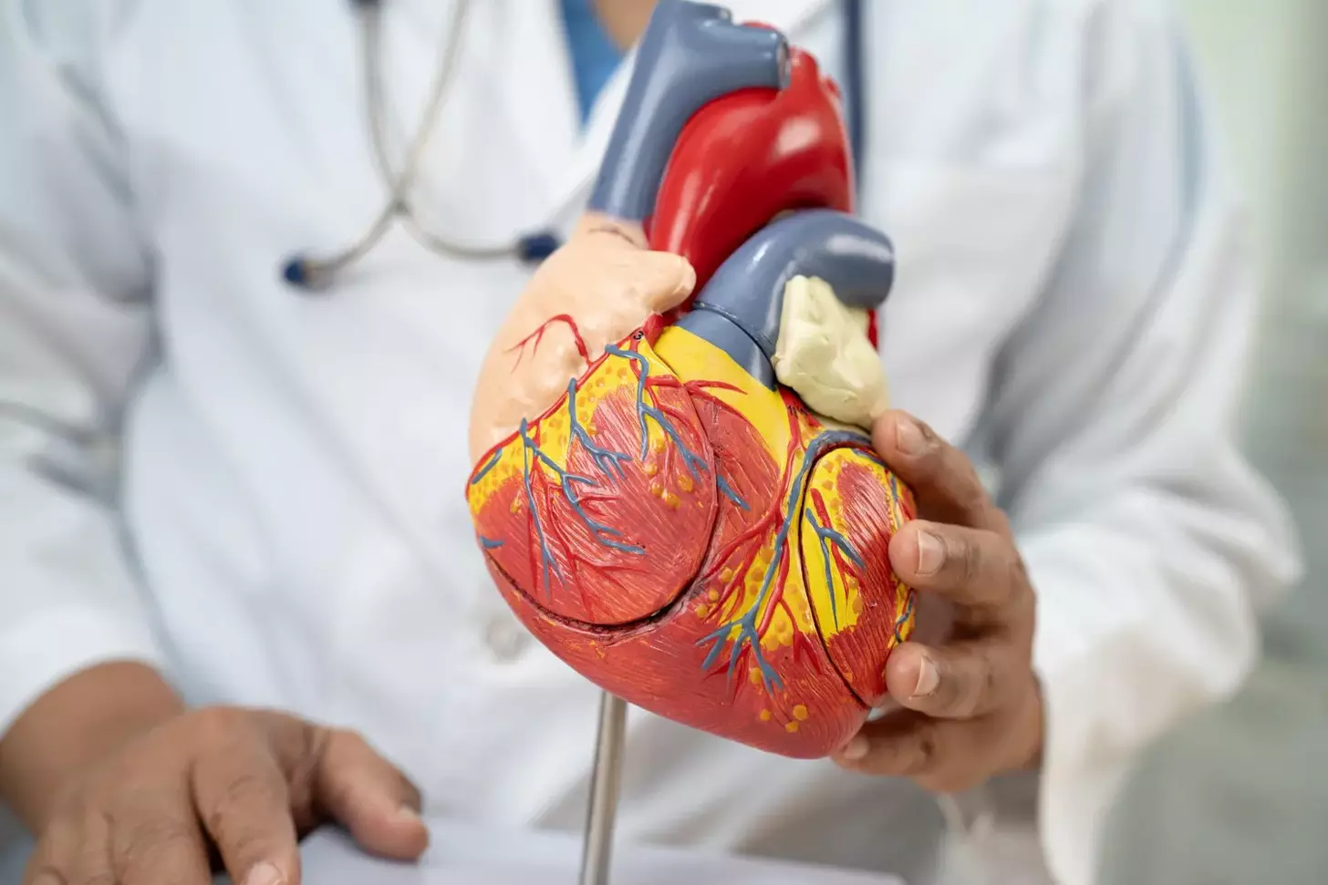 What Does MI Stand for in Medical Terms and Why Is It So Important?