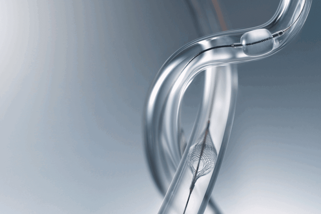 How Big Is a Stent? Heart Stent Size Guide 3 How Big Is a Stent? Heart Stent Size Guide