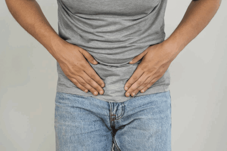 Are Navel Hernias Dangerous? When to Get Surgery