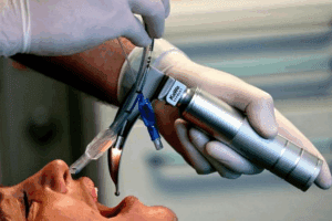 General Anaesthetic Intubation: Safe Steps