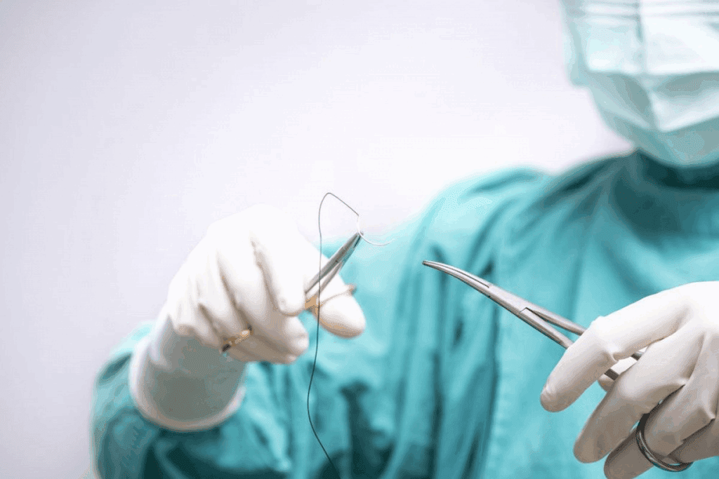 Surgical Fistula: Seton Procedure Guide