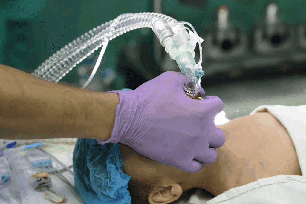 Do You Have to Be Intubated for General Anesthesia? 1 Do You Have to Be Intubated for General Anesthesia?