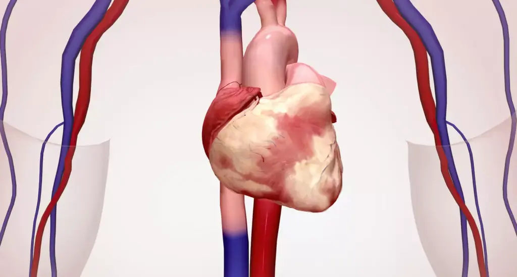  Aortic Tears and Their Life-Threatening Nature