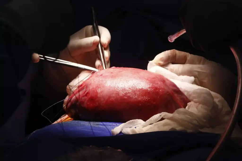 Aortic Anatomy Aortic Anatomy