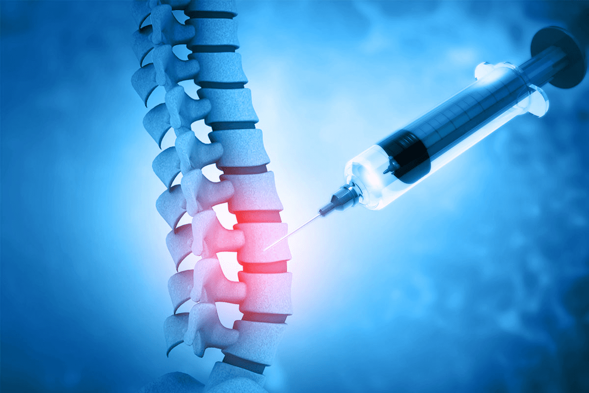 Cervical Radiofrequency Ablation: Ultimate Guide - Liv Hospital