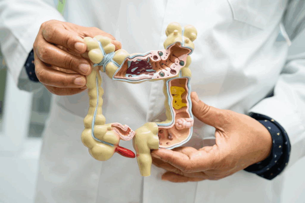 Lost Weight After Gallbladder Removal: 7 Key Facts