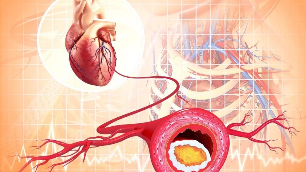 ascending thoracic aorta diameter